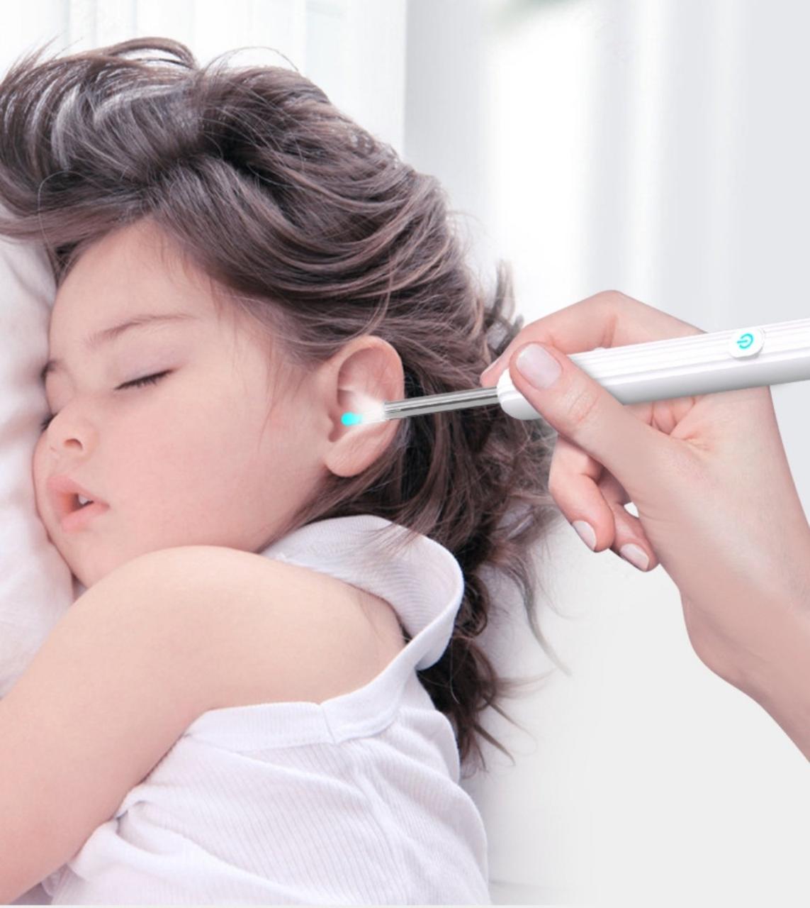 Отоскоп для телефона NE7 Wi-Fi HD 6 LED ламп 3,6 мм Білий (2087295699) - фото 10 Отоскоп для телефона NE7 Wi-Fi HD 6 LED ламп 3,6 мм Білий (2087295699) - фото 10