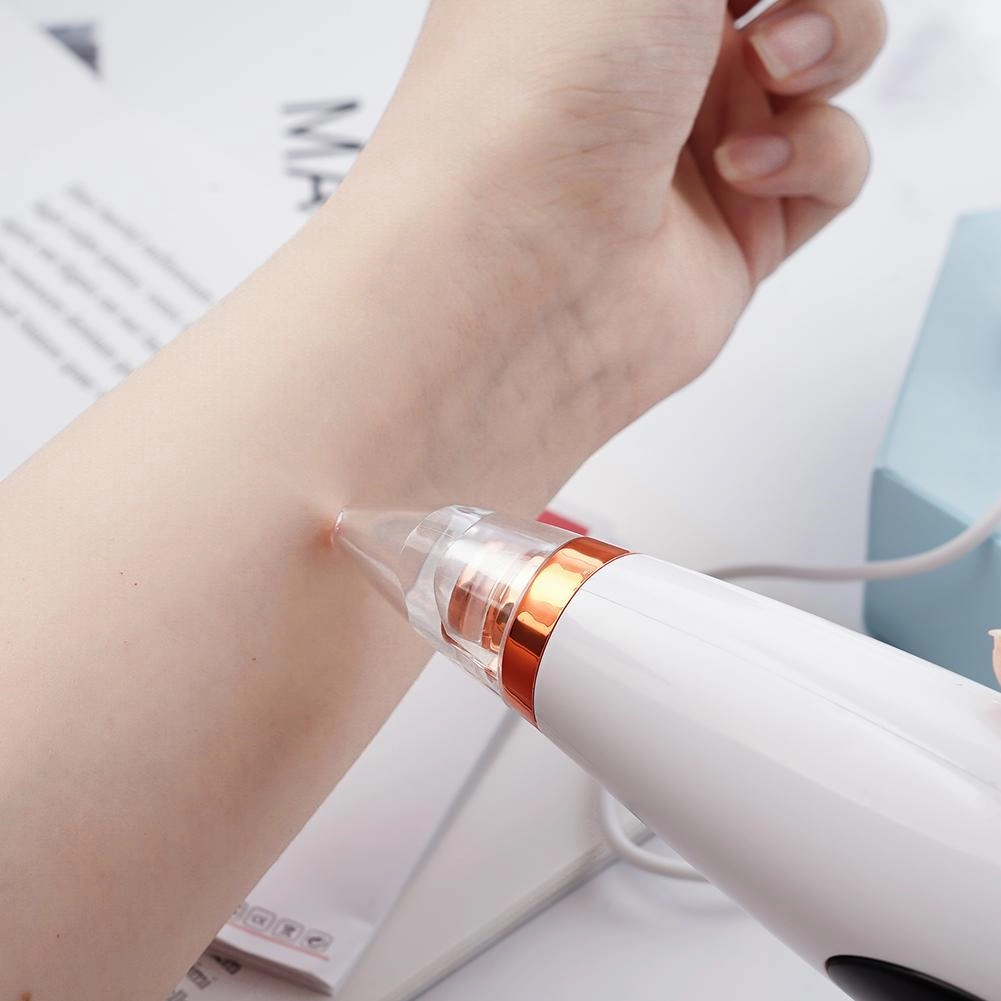 Вакуумный аппарат для очистки кожи и пор (29433551) - фото 6