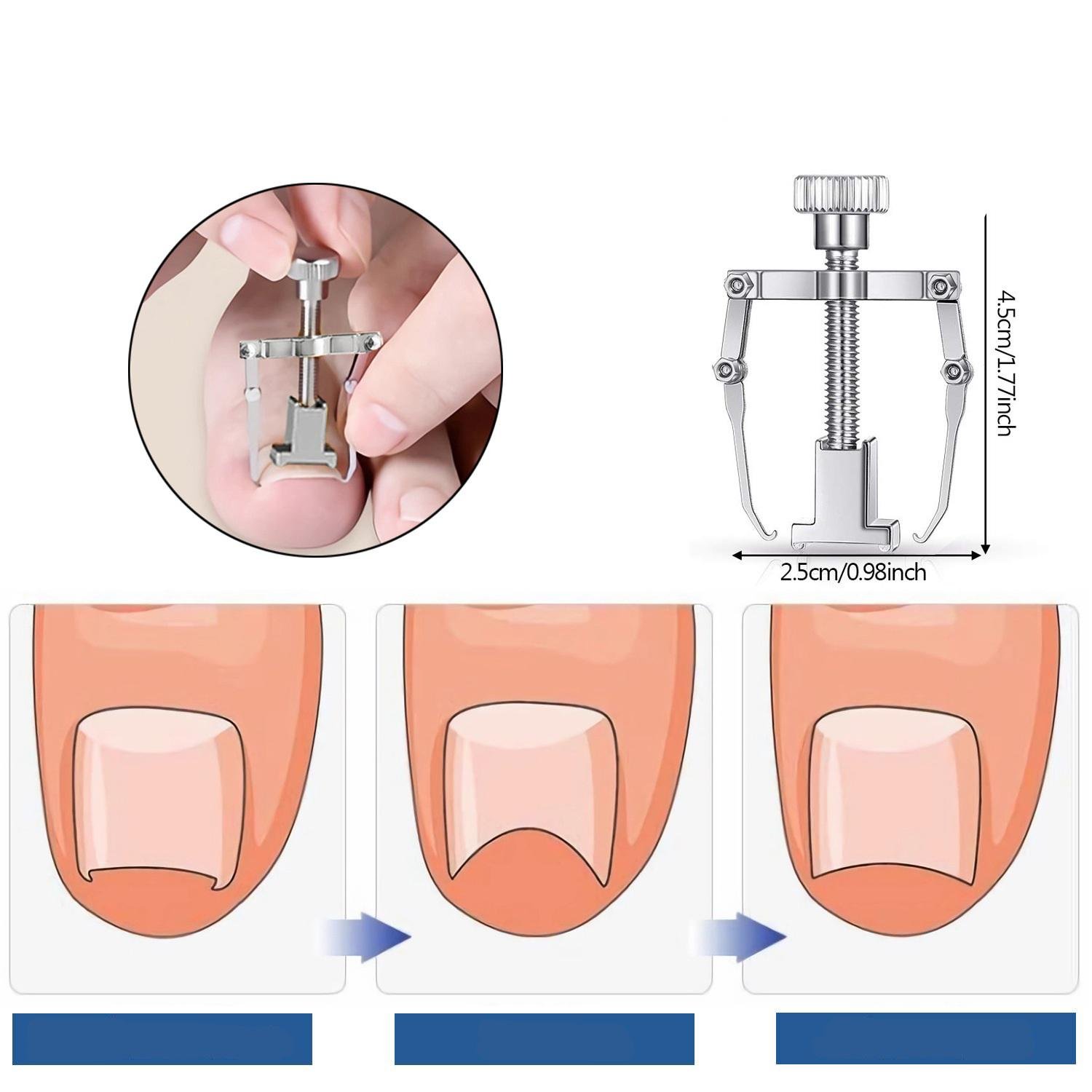 Коректор з металу для лікування врослого нігтя (R9480) - фото 10