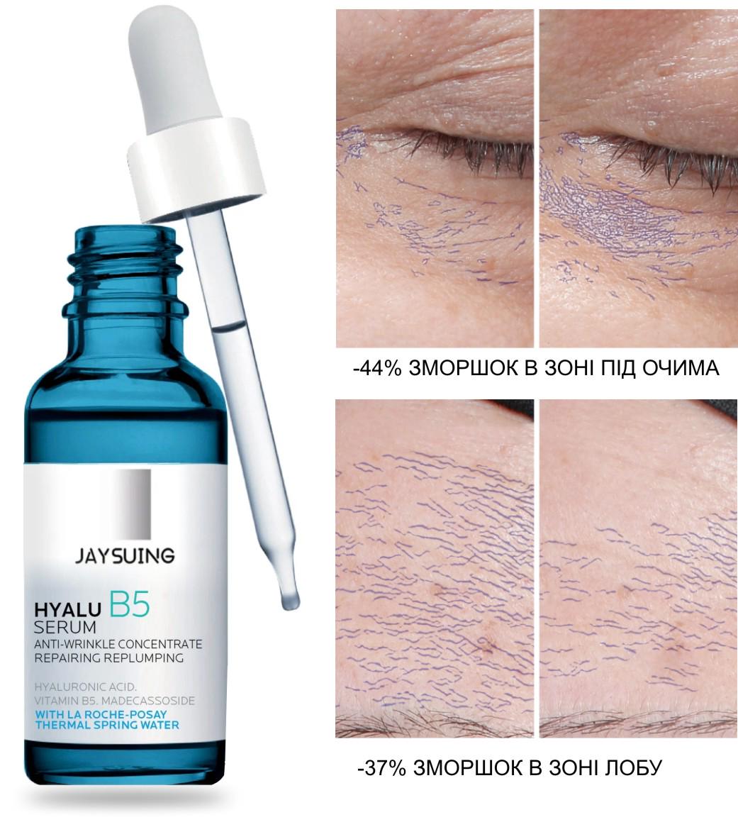 Cыворотка с гиалуроновой кислотой HYALU B5 serum антивозрастная/отбеливающая (421625277) - фото 7