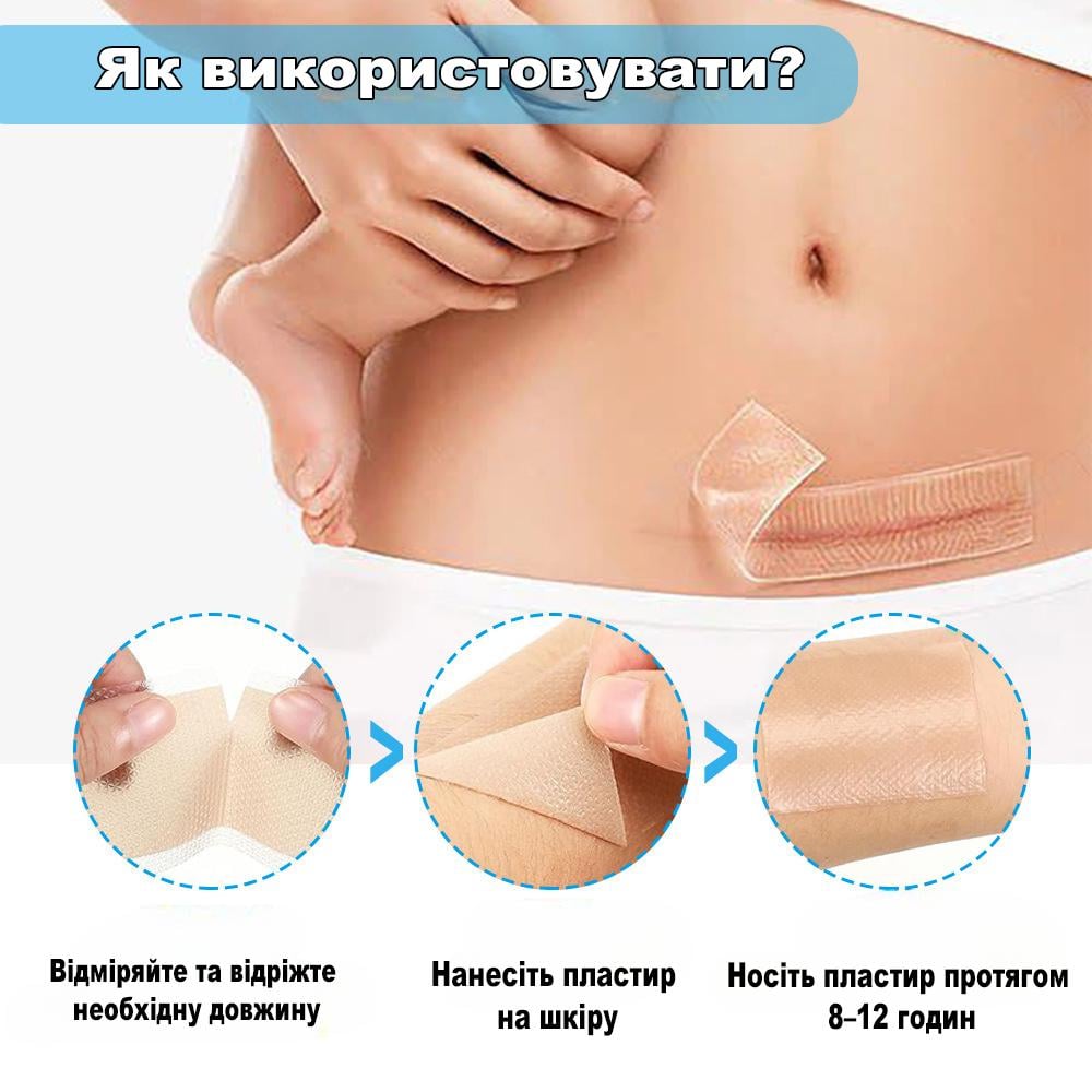Силіконовий пластир від післяопераційних рубців/для шрамів після кесаревого/швів/опіків 4х150 см (R9379) - фото 2 Силіконовий пластир від післяопераційних рубців/для шрамів після кесаревого/швів/опіків 4х150 см (R9379) - фото 2