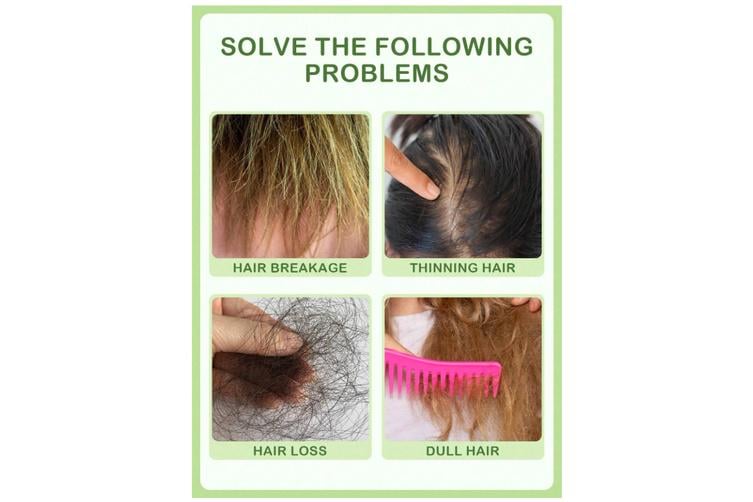 Масло эфирное для волос и кожи головы Slow Sunday Rosemary 15 мл - фото 4 Масло эфирное для волос и кожи головы Slow Sunday Rosemary 15 мл - фото 4