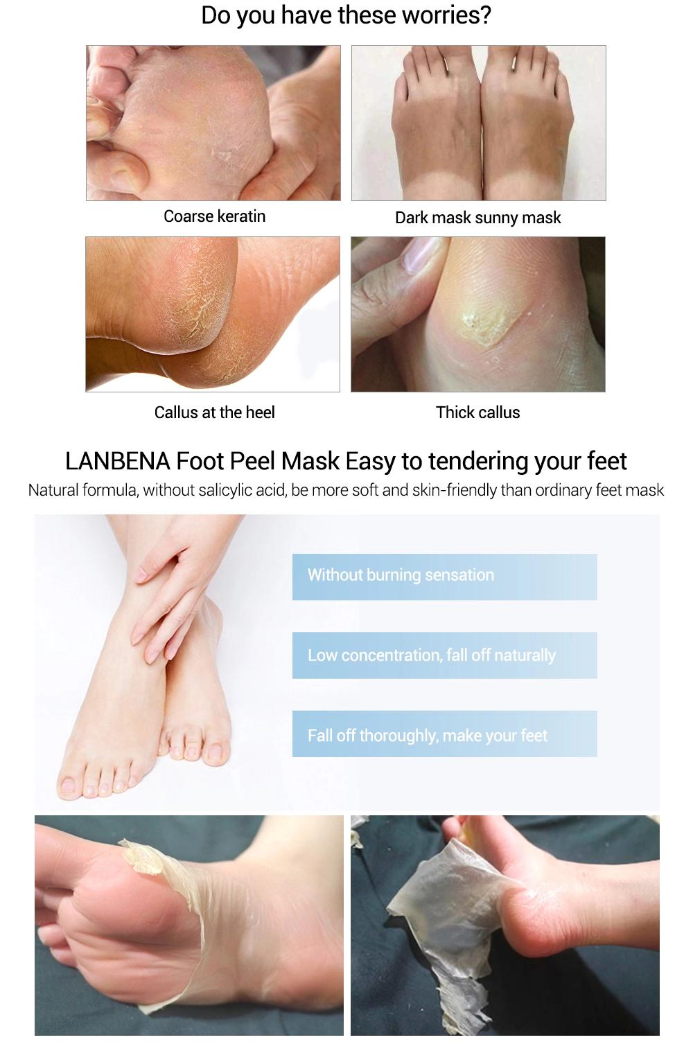 Маска-пілінг для ніг Lanbena Foot Peel Mask Vitamin C 40 г - фото 5