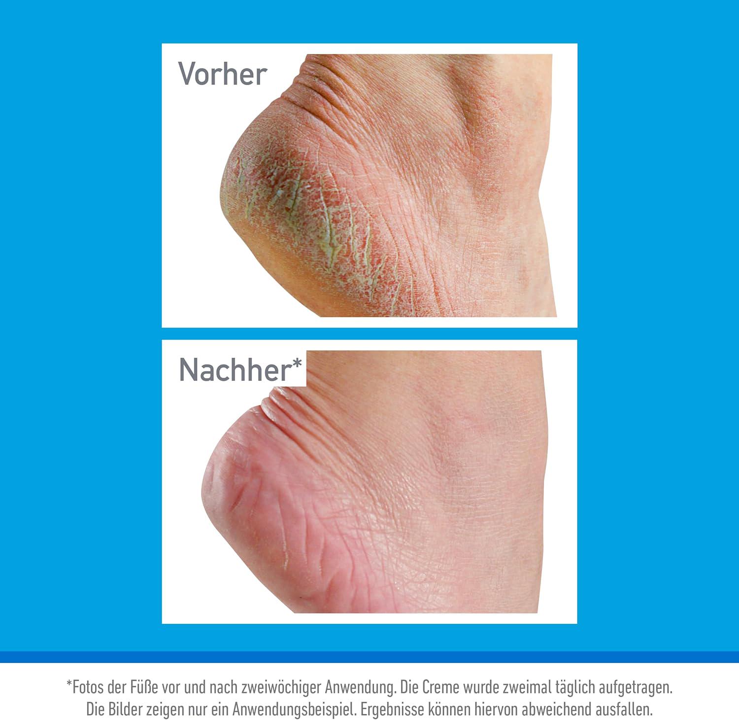 Подарочный набор O'Keeffe's крем для рук/крем для ног и бальзам маска для губ Working Hands/Healthy Feet/Lip Repair (2799786710) - фото 2 Подарочный набор O'Keeffe's крем для рук/крем для ног и бальзам маска для губ Working Hands/Healthy Feet/Lip Repair (2799786710) - фото 2