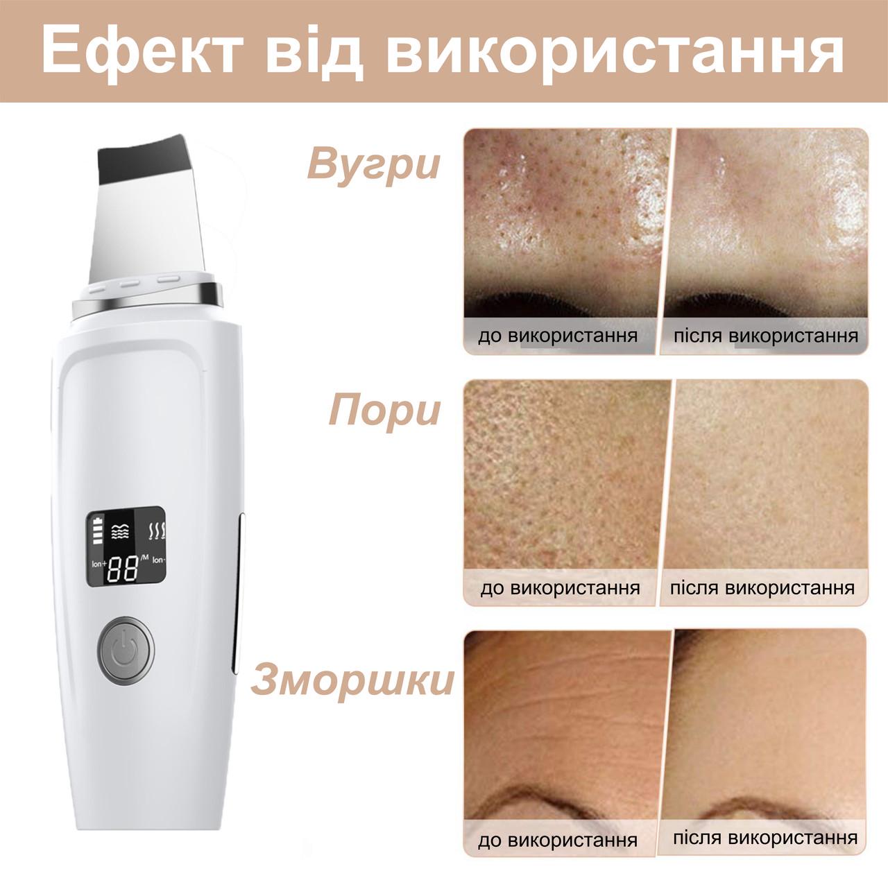 Скрабер ультразвуковий Ultrasonic Skin Cleaner MC-02 з LED-дисплеєм/іонізацією і функцією нагрівання (137057) - фото 8