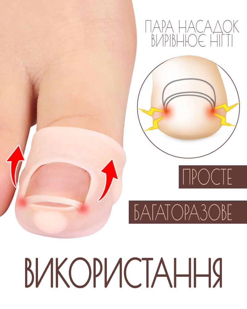 Коректори силіконові від вростання та для корекції нігтів на ногах 2 накладки (KORNIG-1351) - фото 2