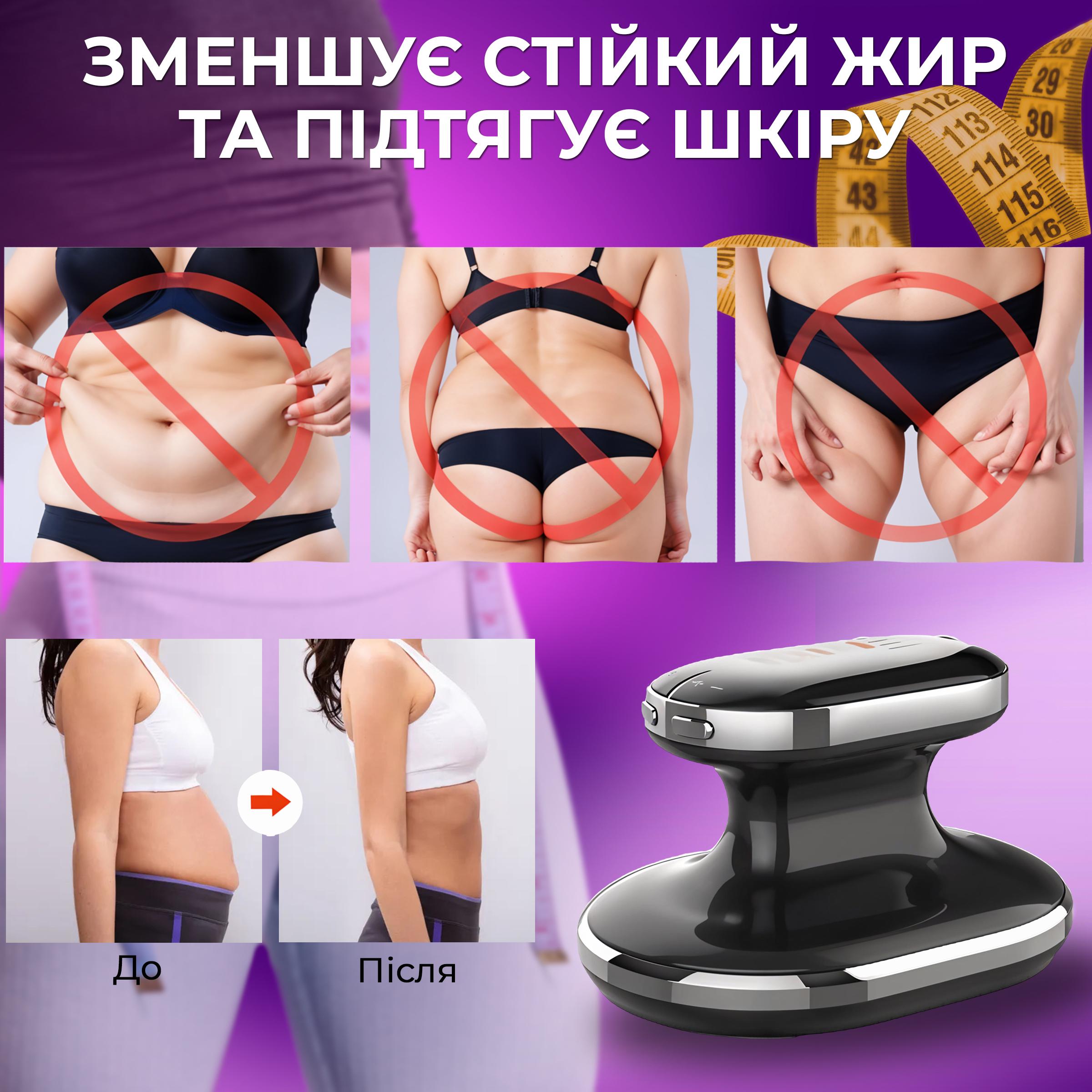 Массажер для тела антицеллюлитный Kayfovo ES-1201 для похудения вибрационный (29230) - фото 5 Массажер для тела антицеллюлитный Kayfovo ES-1201 для похудения вибрационный (29230) - фото 5