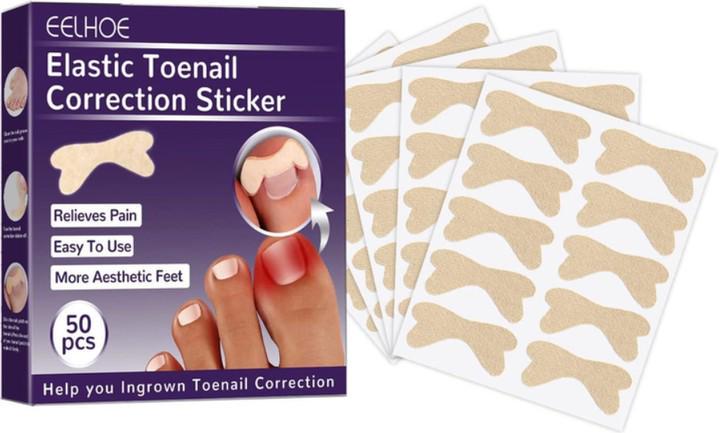 Набор для коррекции врастающих ногтей Elastic Toenail Correction Sticker 50 шт. (2104618421)