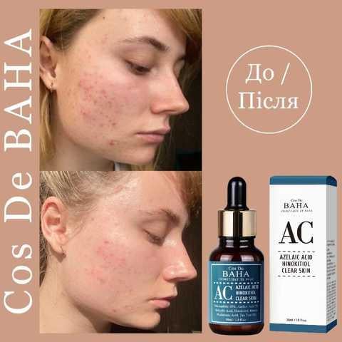 Сироватка Cos de Baha Azelaic Acid Hinokitiol Clear Skin Serum протизапальна для боротьби з акне 30 мл - фото 2