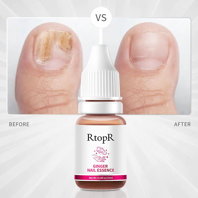 Защитный гель для восстановления ногтей RtopR Ginger Nail Essence 10 мл - фото 2