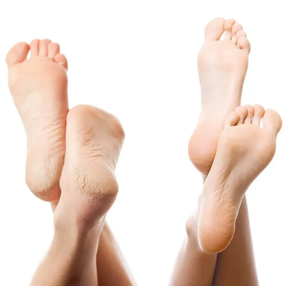 Апарат для педикюру PEDI PRO Deluxe (30444385) - фото 2