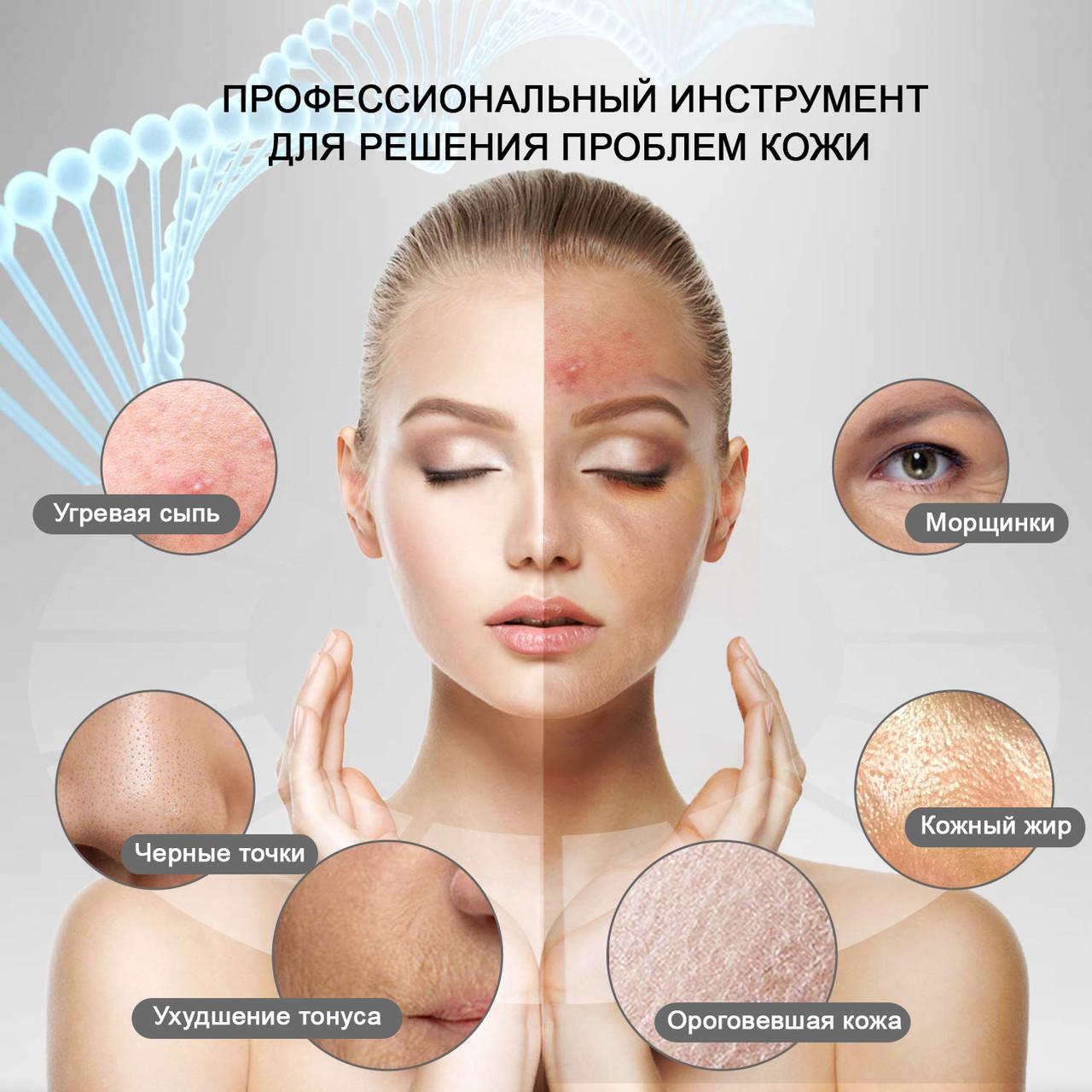 Скрабер для чистки обличчя Ultrasonic Skin Cleaner X6 ультразвуковий для чистки лиця/пілінгу LED-дисплей (9860211) - фото 6