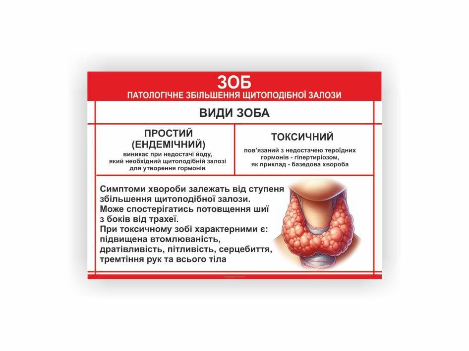 Плакат Vivay Зоб 60х80 см (25650975)