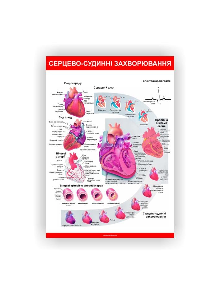 Плакат Vivay Серцево-судинні захворювання 60х80 см (25649898)