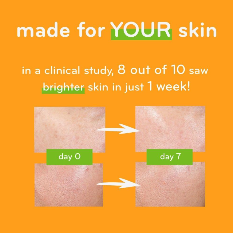 Лосьон для тела с витамином С Aмлactin Daily Vitamin C 225 г - фото 5 Лосьон для тела с витамином С Aмлactin Daily Vitamin C 225 г - фото 5