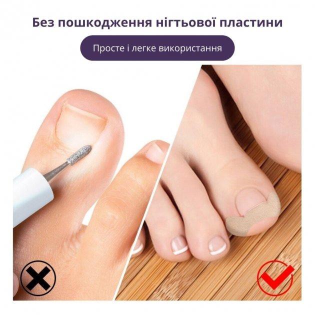 Набор пластырей Elastic Toenail Correction Sticker для безболезненной коррекции вросших ногтей 50 шт. (9388-3) - фото 4