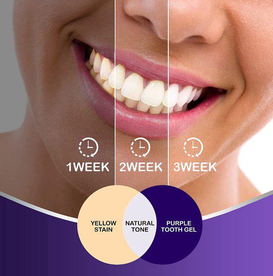 Средство для освещения тона зубов Hismile v34 Color Corrector 30 мл Филолетовый - фото 2 Средство для освещения тона зубов Hismile v34 Color Corrector 30 мл Филолетовый - фото 2