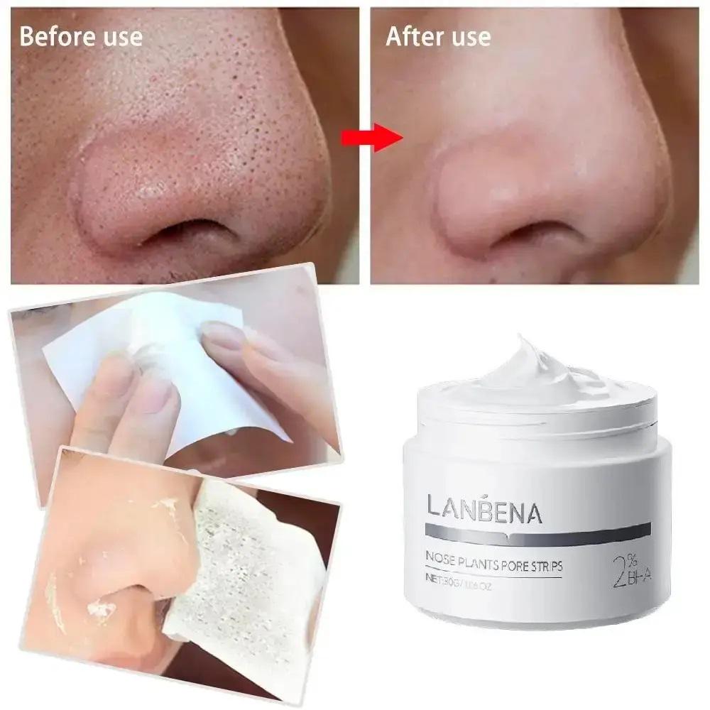 Маска для обличчя Lanbena від вугрів і чорних крапок 30 г з 60 смужками 30 г (27259378) - фото 5 Маска для обличчя Lanbena від вугрів і чорних крапок 30 г з 60 смужками 30 г (27259378) - фото 5