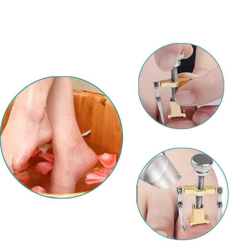 Коректор з металу для лікування врослого нігтя (R9480) - фото 3