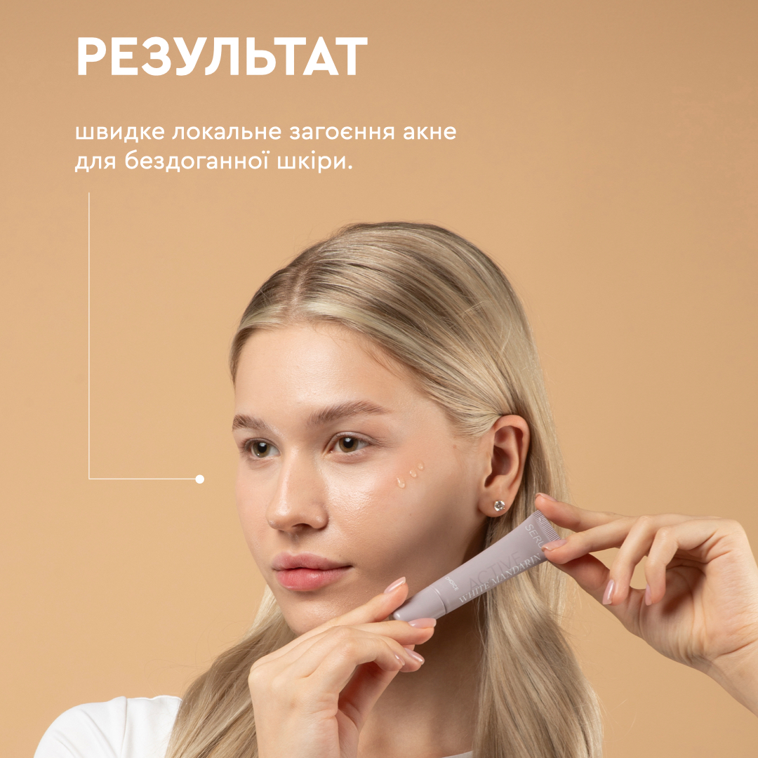 Сироватка антиакне для проблемної шкіри обличчя Serum Active White Mandarin 15 мл (99101197101) - фото 5