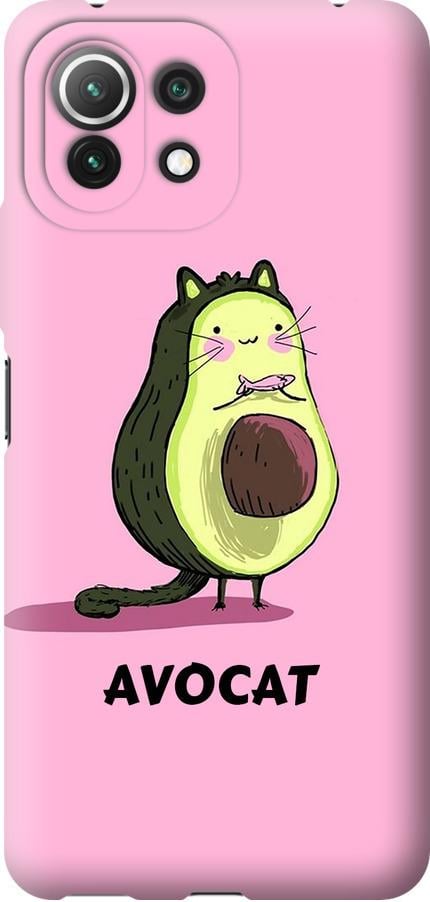 Чехол на Xiaomi Mi 11 Lite Avocat (4270u-2281-42517)