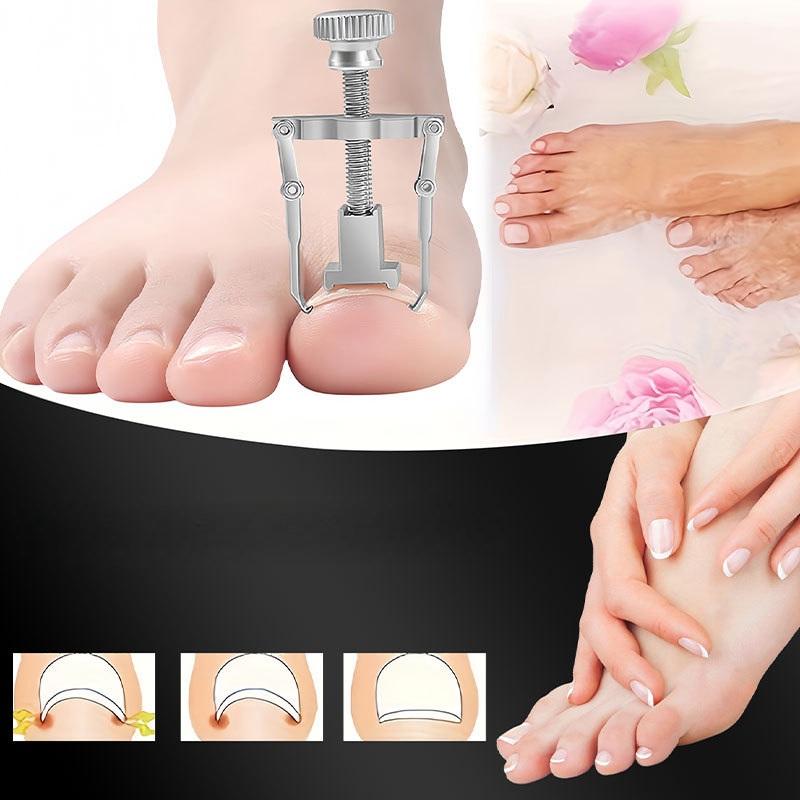 Коректор з металу для лікування врослого нігтя (R9480) - фото 7