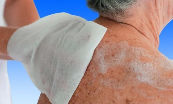 Вологі миючі рукавички MoliCare Skin 8 шт. - фото 2 Вологі миючі рукавички MoliCare Skin 8 шт. - фото 2