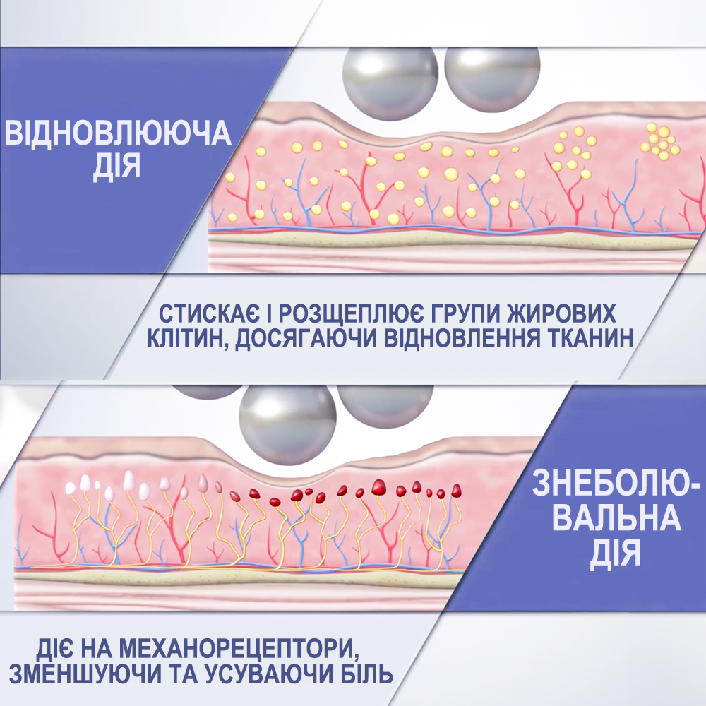 Апарат для вакуумно-роликового масажу Reshape Spheresculpt/професійний антицелюлітний для тіла обличчя та шиї - фото 9