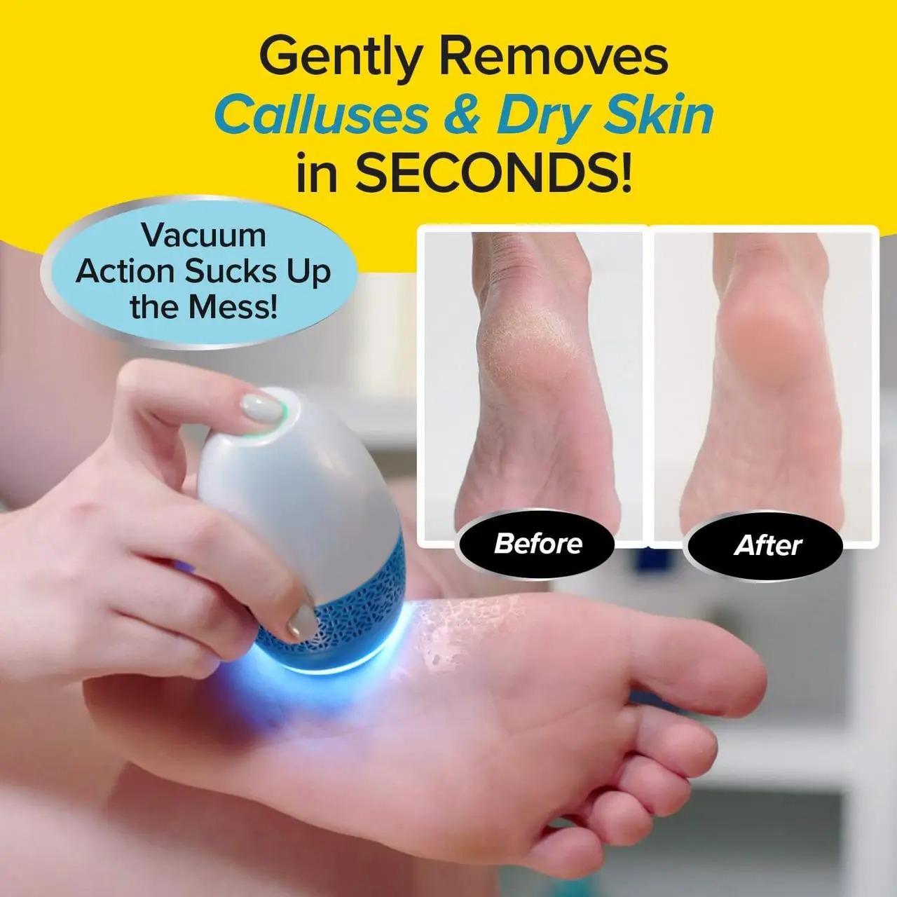 Пилка аккумуляторная Calluses Remover 2 насадки - фото 9