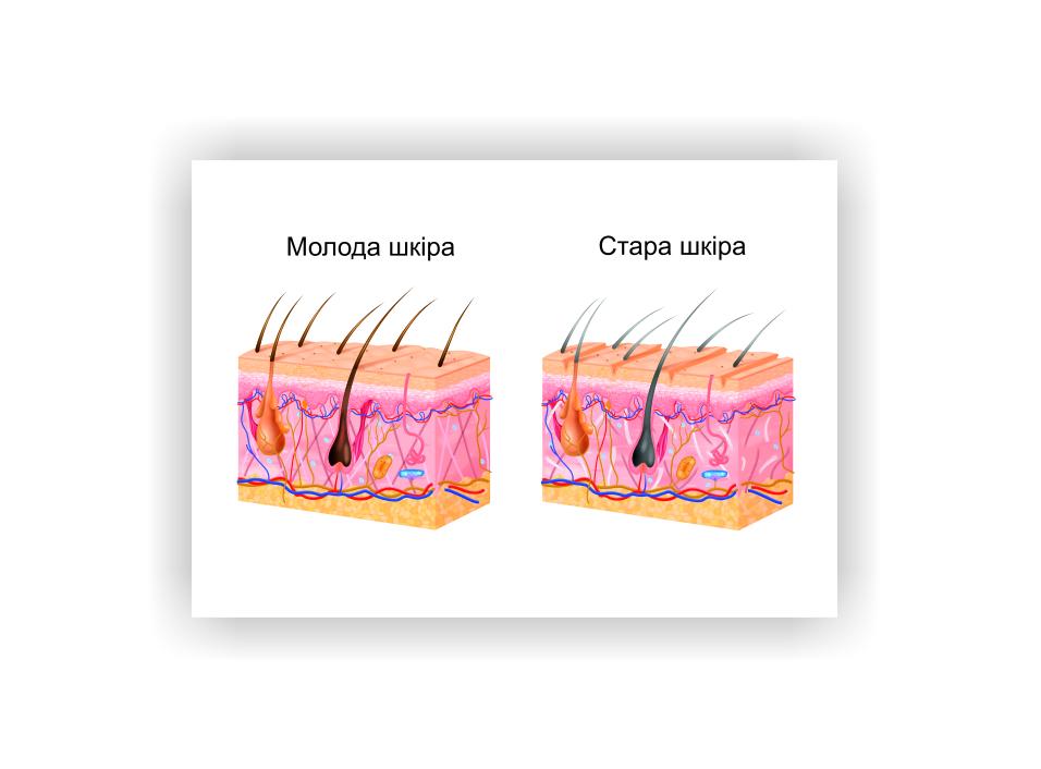 Плакат Vivay "Молодая кожа. Старая кожа" 60х40 см (25604167)