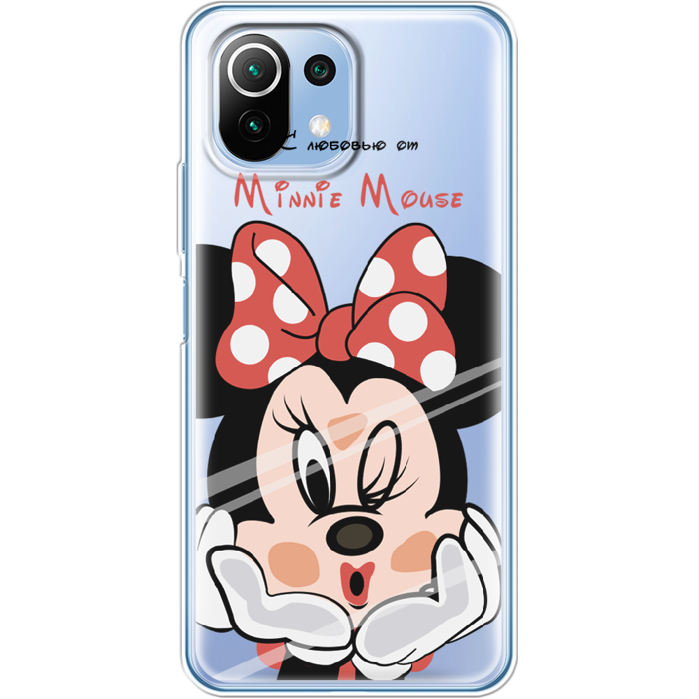 Чехол Boxface Xiaomi Mi 11 Lite Lady M Прозрачный силикон (42128-cc59-42128)