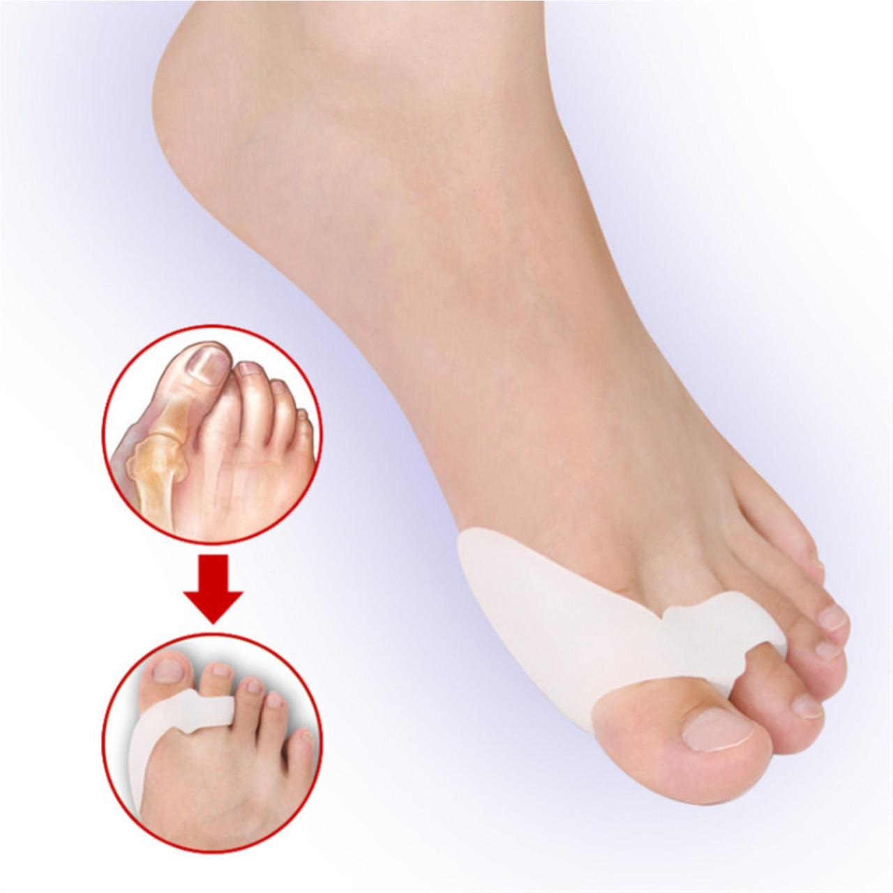 Фиксатор косточки и большого пальца Hallux Valgus Pro+ медицинский (137889) - фото 3 Фиксатор косточки и большого пальца Hallux Valgus Pro+ медицинский (137889) - фото 3