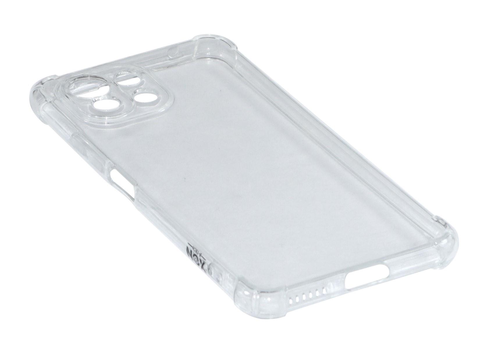 Чохол XON PhoneCase для Xiaomi Mi 11 Lite (PCSA3111101T 0502) Прозорий - фото 2 Чохол XON PhoneCase для Xiaomi Mi 11 Lite (PCSA3111101T 0502) Прозорий - фото 2