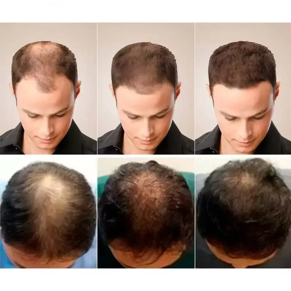 Масло для роста волос 35 мл LUNOON/Масло (30444392) - фото 3 Масло для роста волос 35 мл LUNOON/Масло (30444392) - фото 3