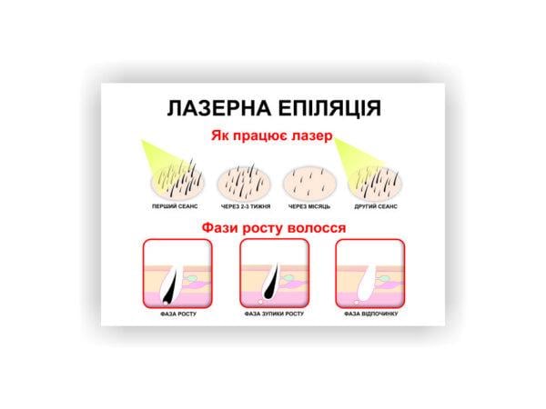 Плакат Vivay Лазерная эпиляция 60х40 см (23266678)