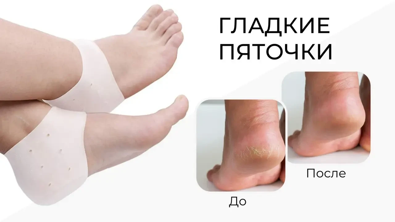 Протектор на п'яту для дорослих Valgus Pro with hole 2 шт. White (16375) - фото 2