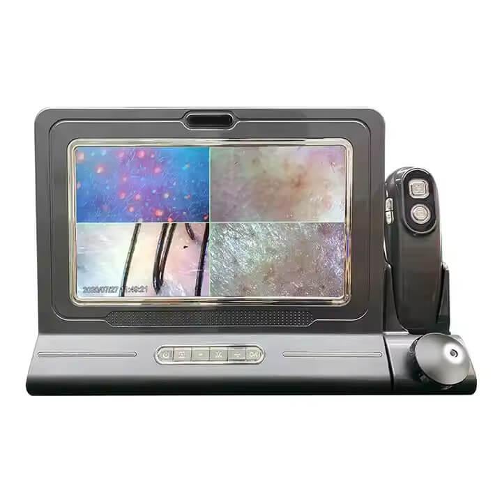 Трихоскоп с экраном профессиональный анализатор кожи головы и волос с 50х-200х кратным увеличением