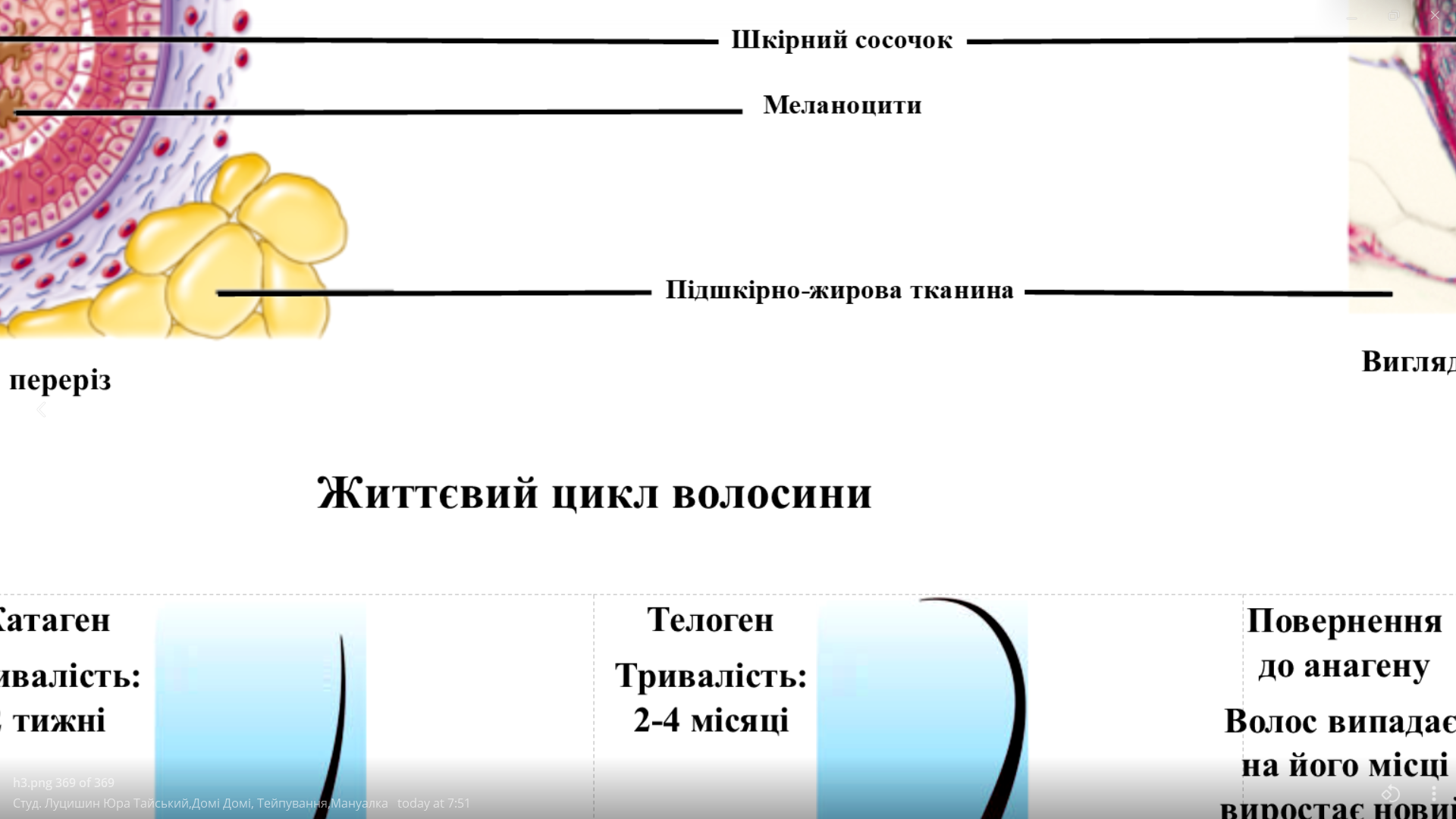 Анатомічний плакат Будова волосяного фолікула 52х67 см (0086) - фото 2