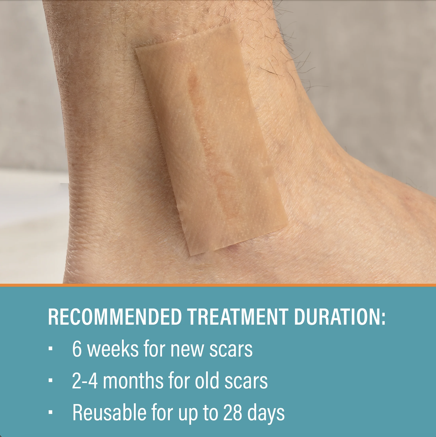 Пластырь силиконовый Nuvadermis от всех видов рубцов и шрамов 7,6х4 см 4 шт. (234567890) - фото 7 Пластырь силиконовый Nuvadermis от всех видов рубцов и шрамов 7,6х4 см 4 шт. (234567890) - фото 7