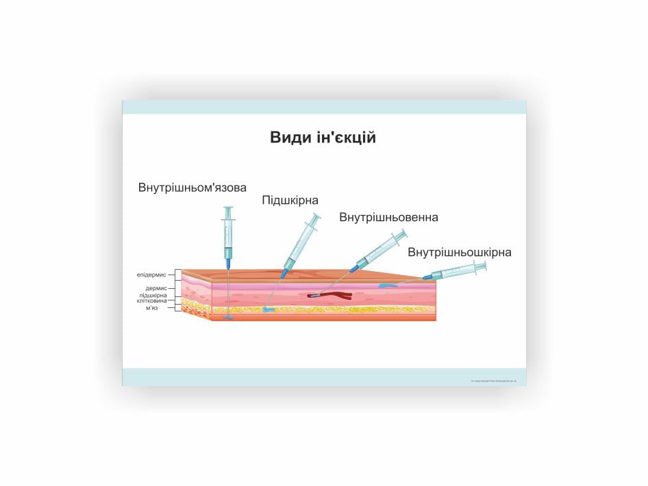 Плакат Vivay Виды инъекций 60х40 см (25870895)