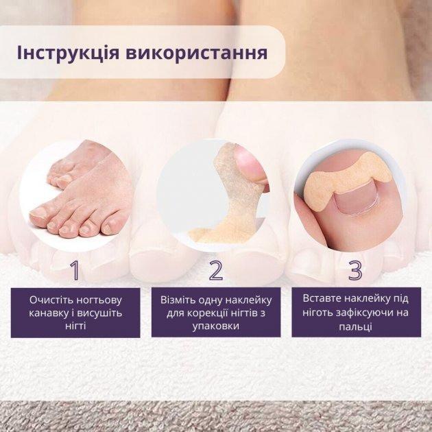 Набір пластирів Elastic Toenail Correction Sticker для безболісної корекції нігтів що вросли 50 шт. (9388-3) - фото 3