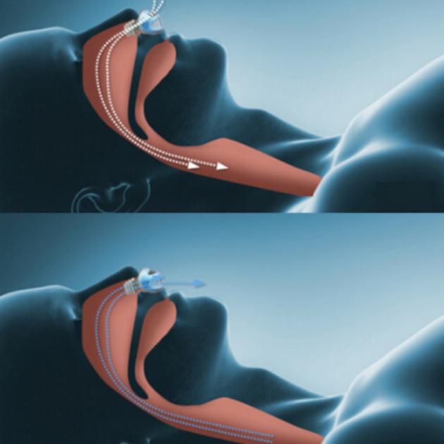 Антихрап Anti Snoring UTM 2в1 - фото 2