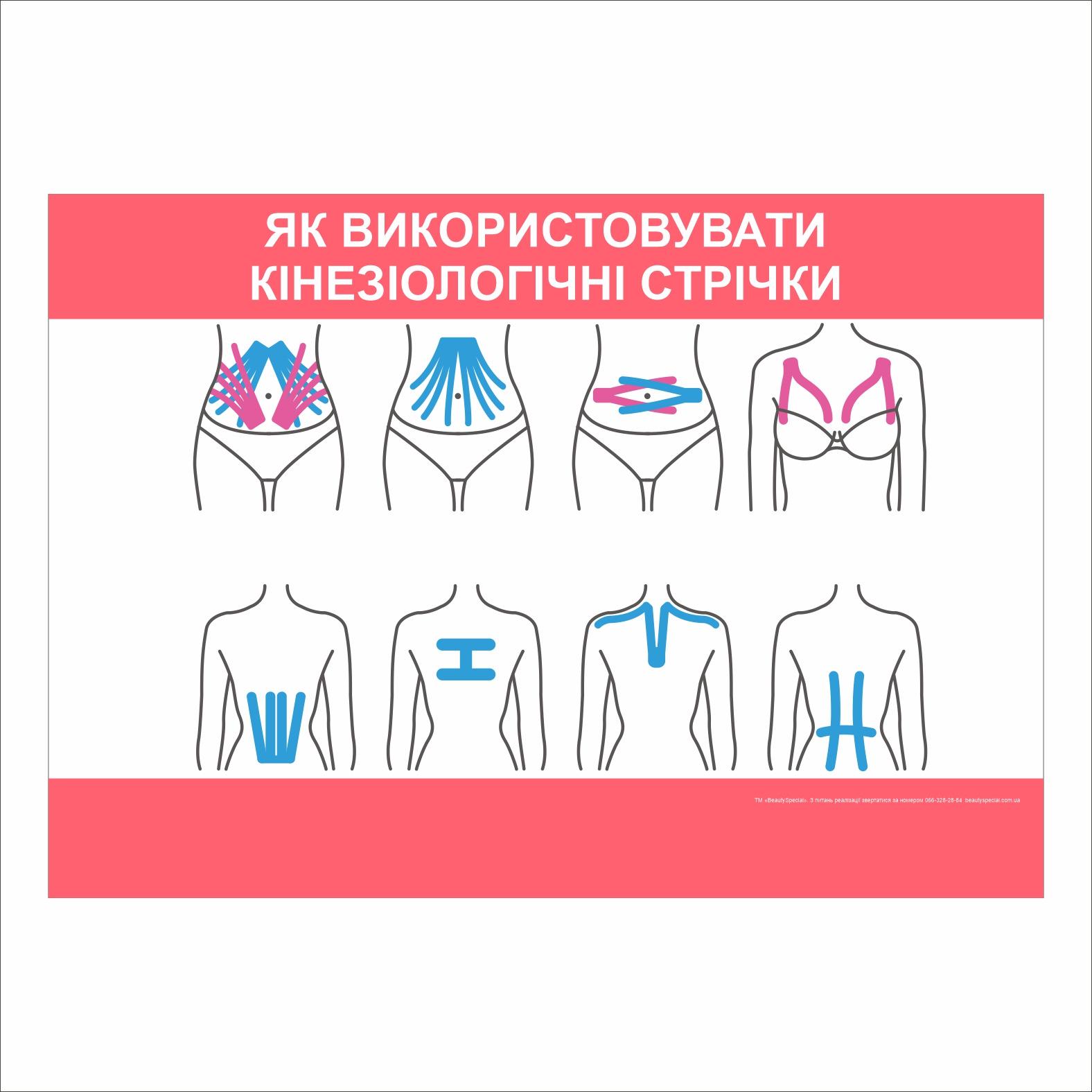 Плакат Vivay "Как использовать кинезиологические ленты" 60х40 см (25789706)