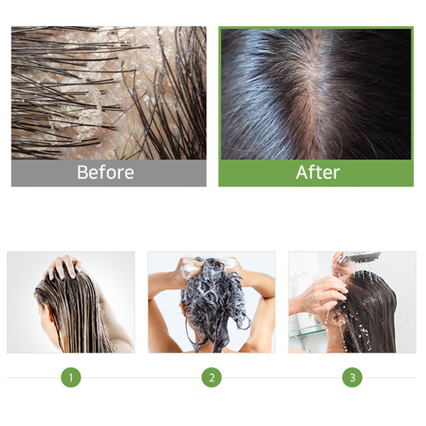 Шампунь безсульфатный с пробиотиками и яблочным уксусом MASIL 5 Probiotics Apple Vinegar Shampoo 8 мл (1510710158) - фото 2 Шампунь безсульфатный с пробиотиками и яблочным уксусом MASIL 5 Probiotics Apple Vinegar Shampoo 8 мл (1510710158) - фото 2