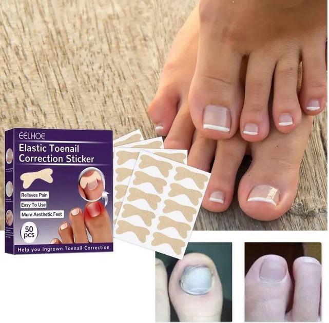 Набор пластырей Elastic Toenail Correction Sticker 50 pcs (ECS1000) - фото 2