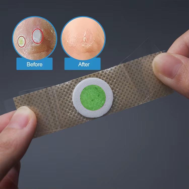 Пластырь от мозолей и натоптышей на растительной основе 12 шт. Бежевый с зеленым (2743174678) - фото 4 Пластырь от мозолей и натоптышей на растительной основе 12 шт. Бежевый с зеленым (2743174678) - фото 4