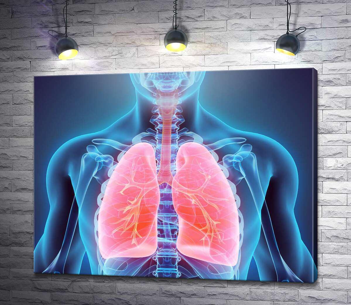 Картина ArtPoster Легкие внутри грудной клетки 130x101 см Модуль №1 (004565)