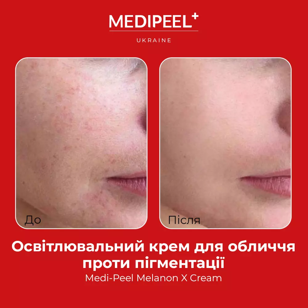 Крем для лица против пигментации Medi-Peel Melanon X Cream 30 мл - фото 8