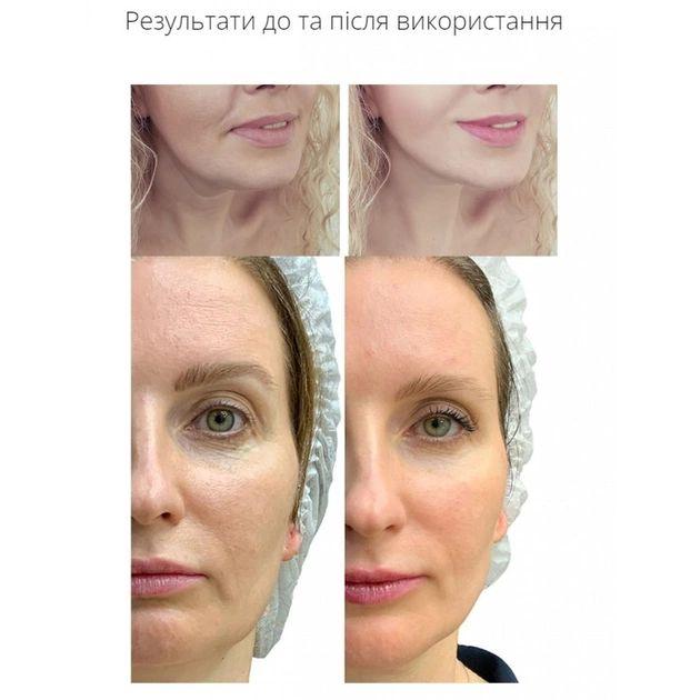 Ліфтинг-масажер для тіла MEDICA+ Skin Lifting 5.0 мікрострумовий (18585) - фото 7