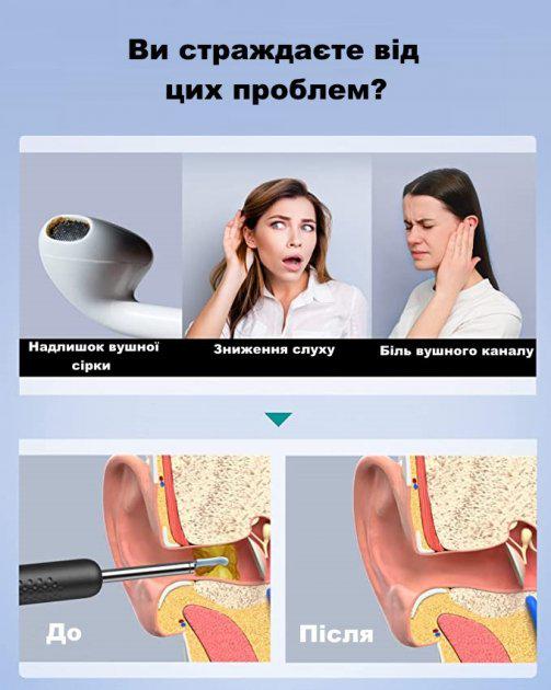 Инструмент для удаления ушной серы BEBIRD R1 с отоскопом 1080P с 2-мя силиконовыми ушными ложечками Черный - фото 2